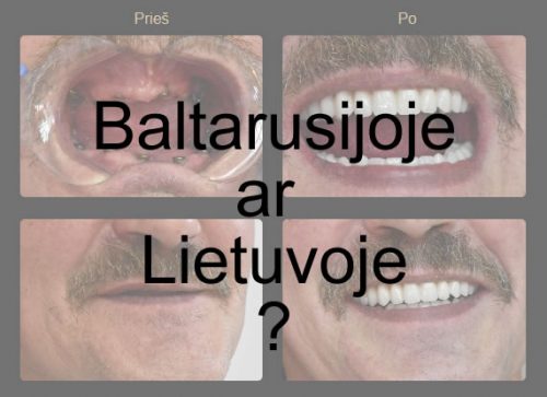 Implantavimas Baltarusijoje